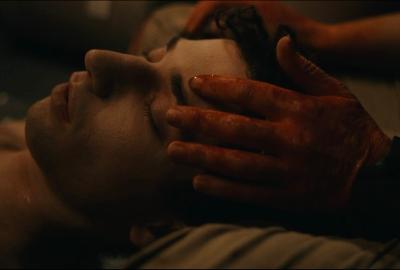 Oli's burned hands on Max's face. 